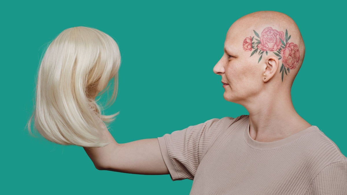 bald woman holding a wig in her hands